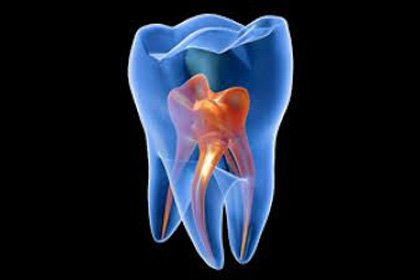 Endodoncia